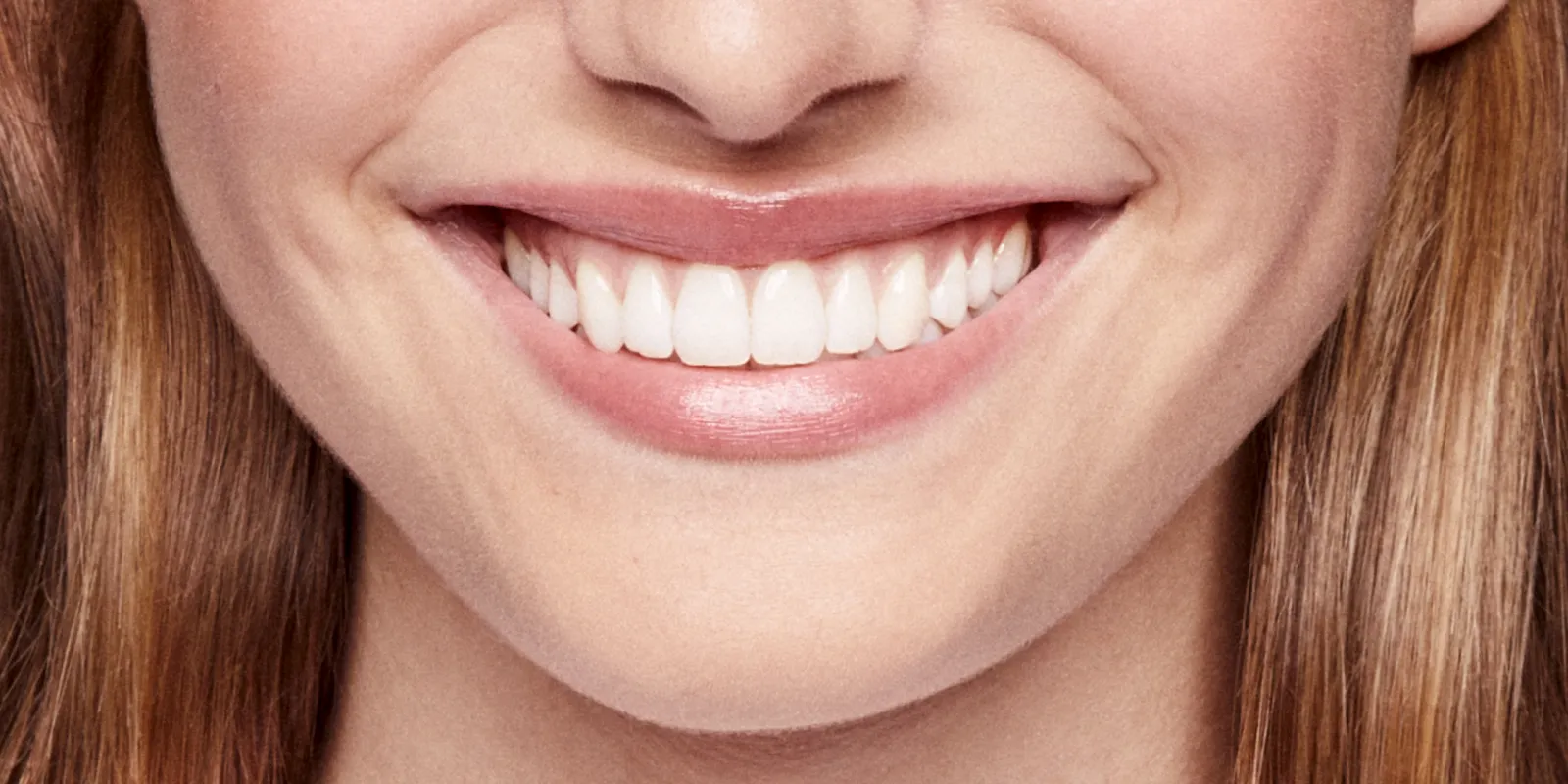 Schöne Zähne Header Bild