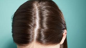 how to treat dry scalp