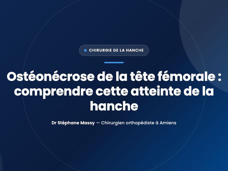Illustration schématique d'une articulation de la hanche montrant la tête du fémur et sa vascularisation