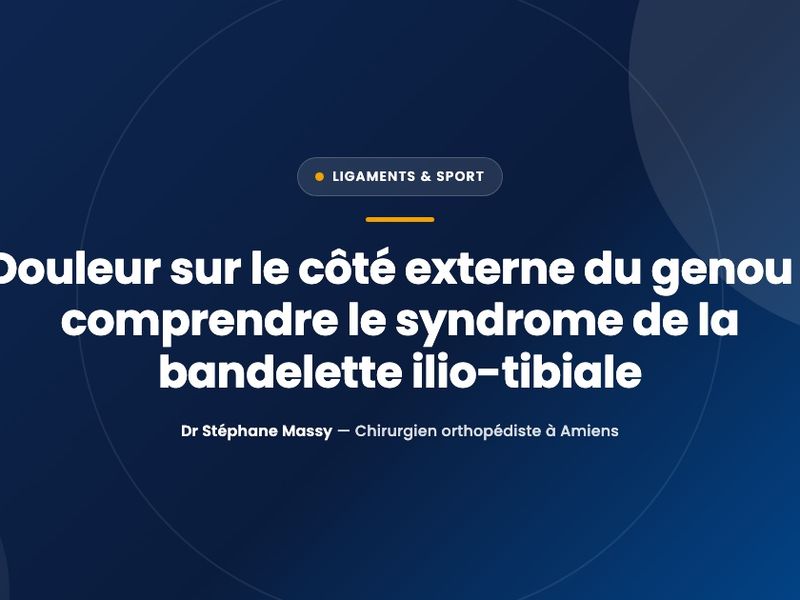 Illustration schématique du genou montrant la bandelette ilio-tibiale qui longe la face externe de la cuisse jusqu'au tibia