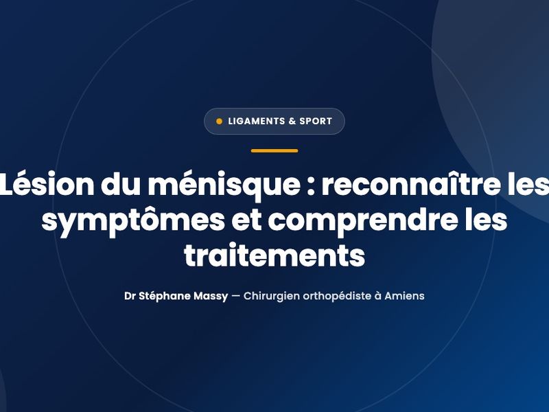 Illustration d'un genou montrant la position des ménisques entre le fémur et le tibia