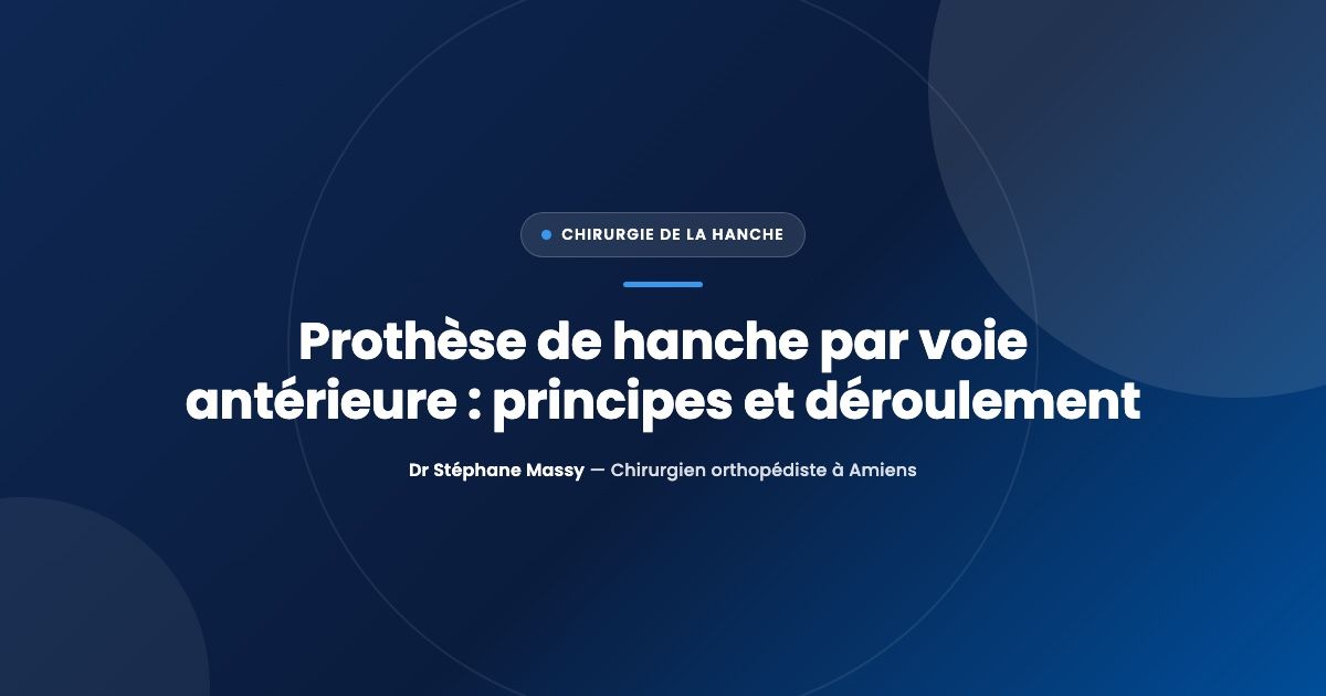 Illustration d'une prothèse de hanche