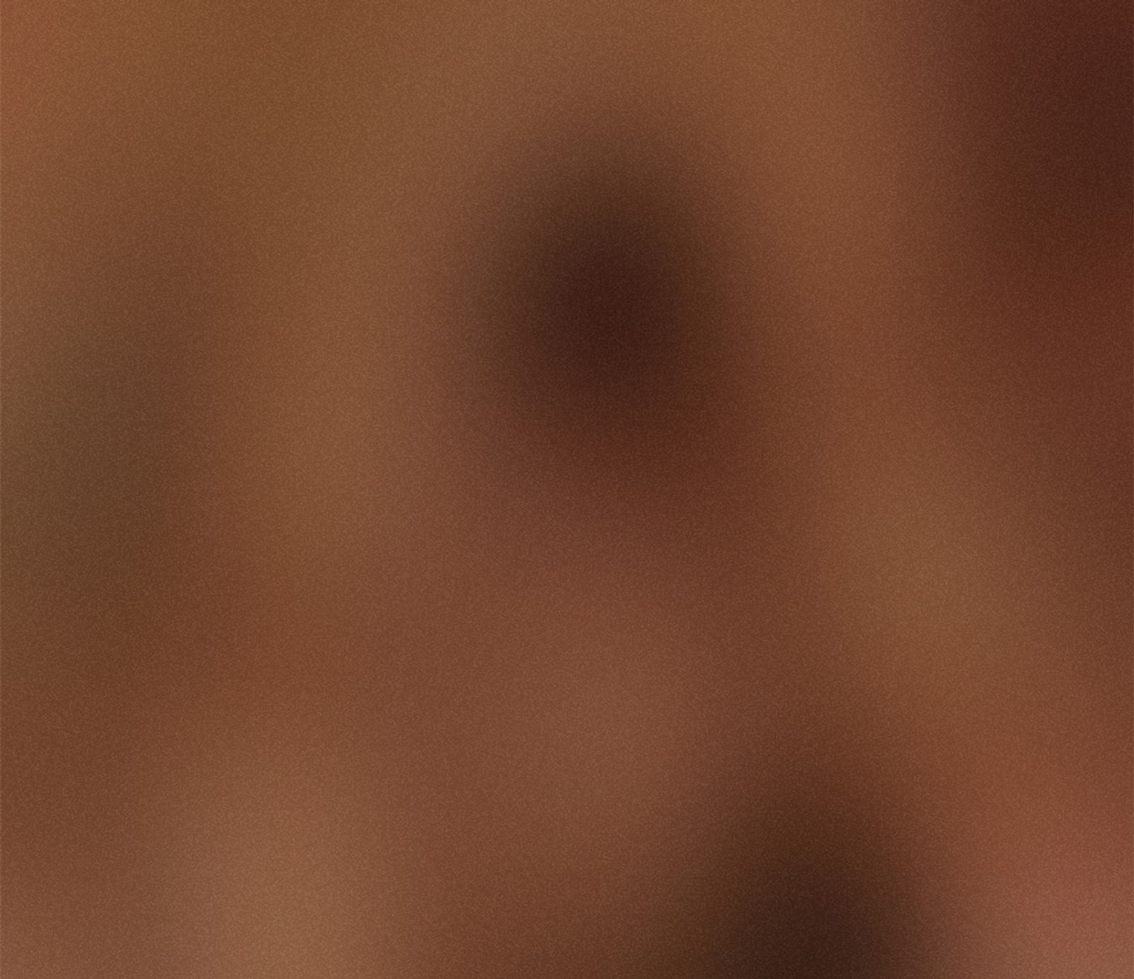 Cyster på eggstokkene