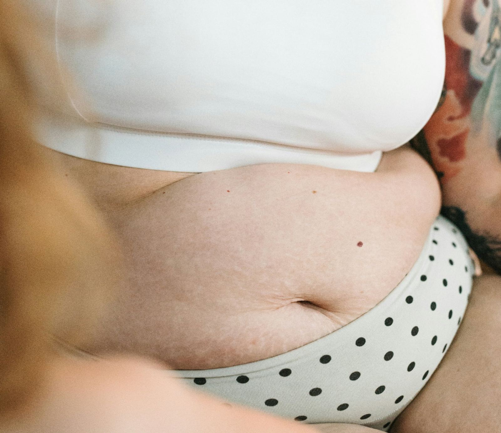 Obesity surgery