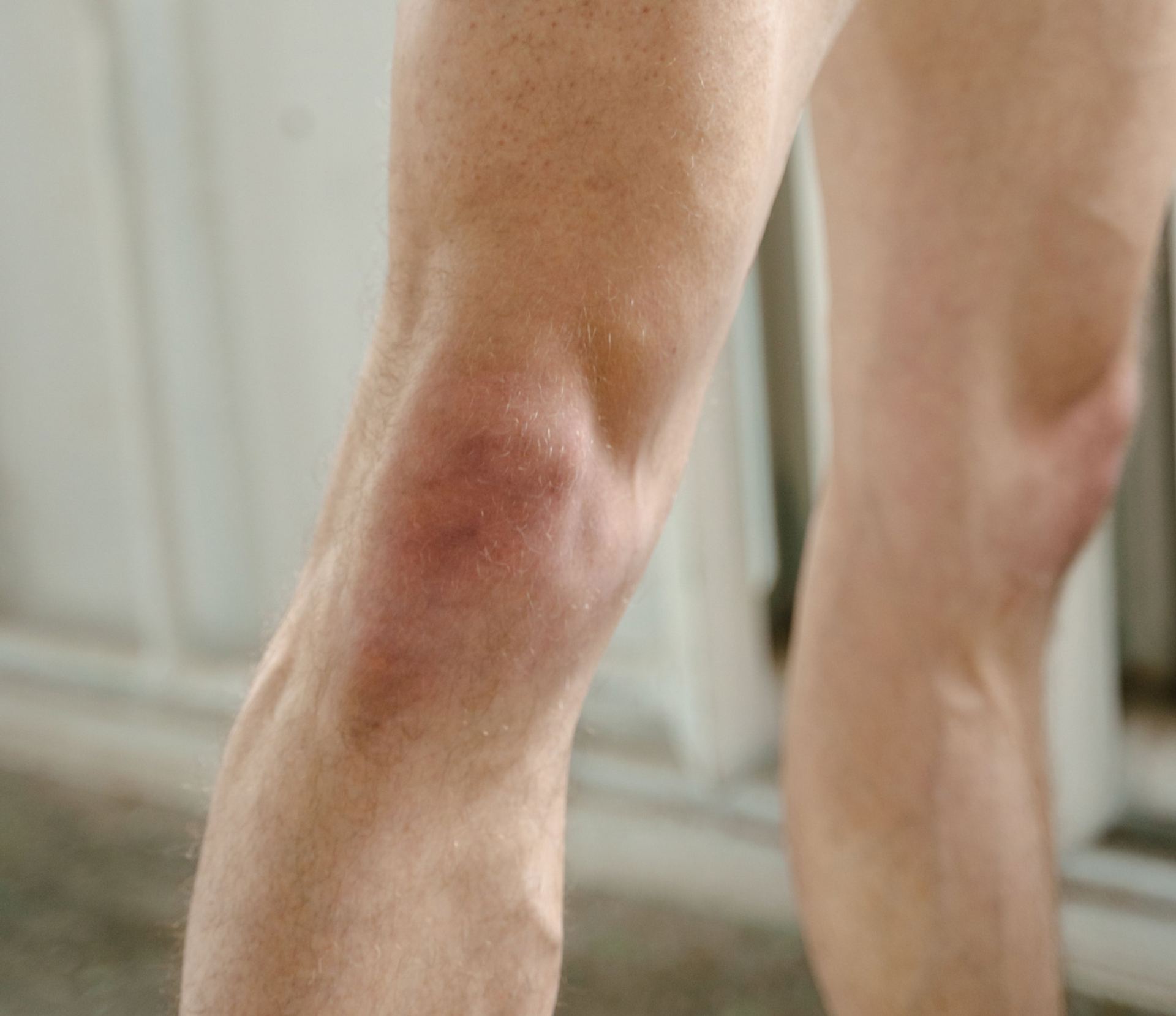 Knee