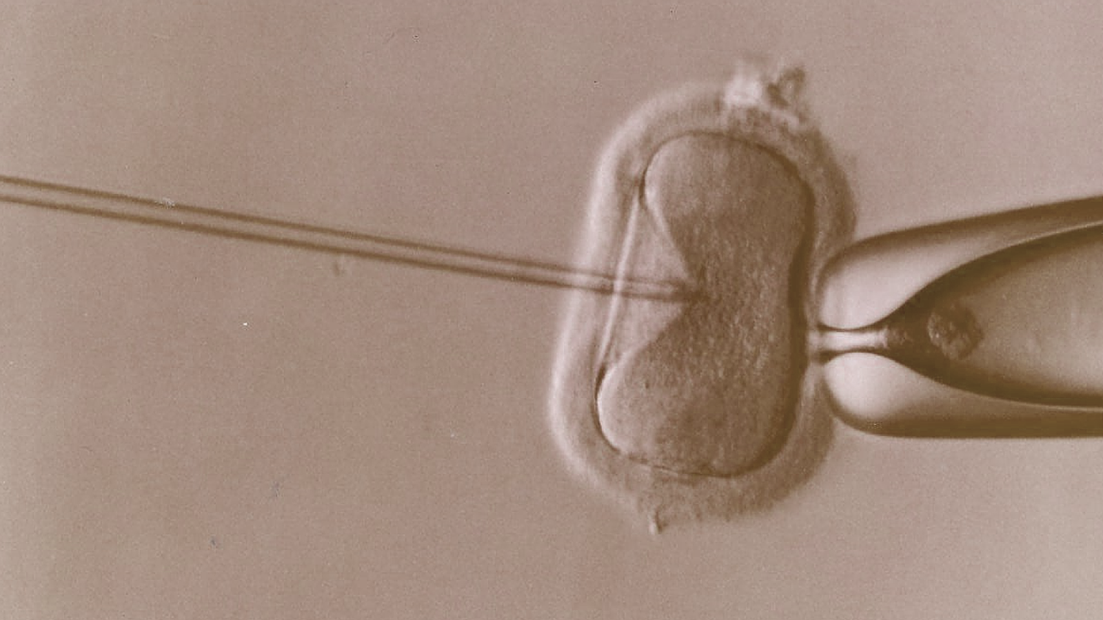 Prisliste for fertilitet