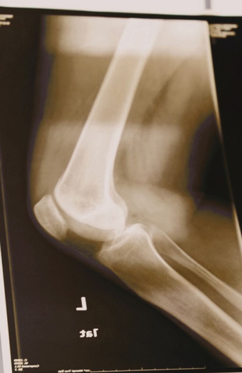 Orthopedics
