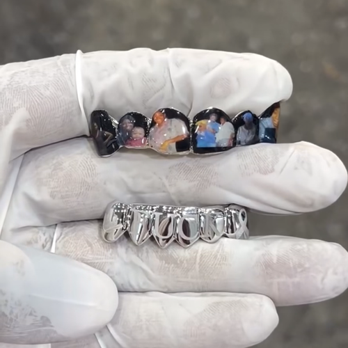 Custom Photo Grillz
