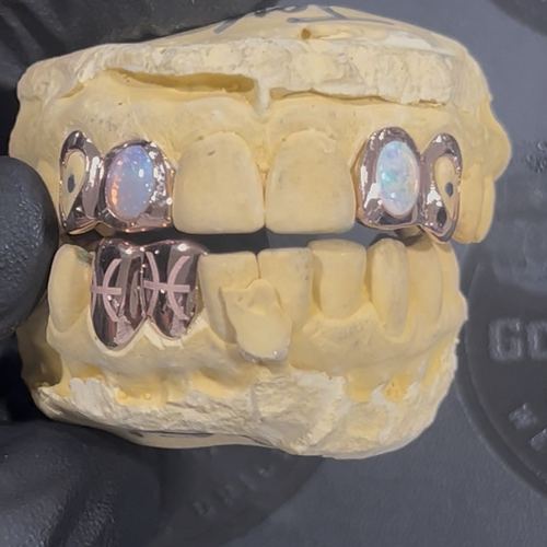 Custom Grillz Orders
