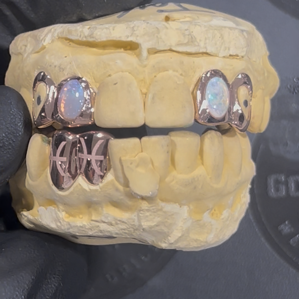 Custom Grillz Orders