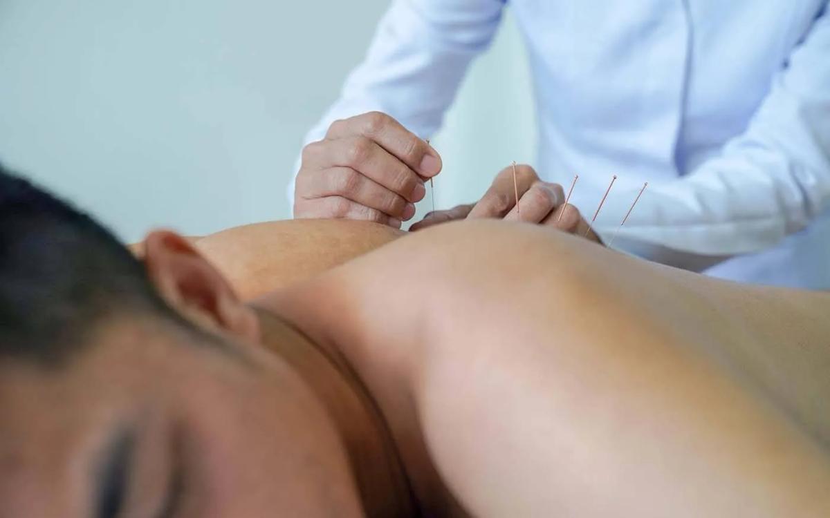 Dry Needling