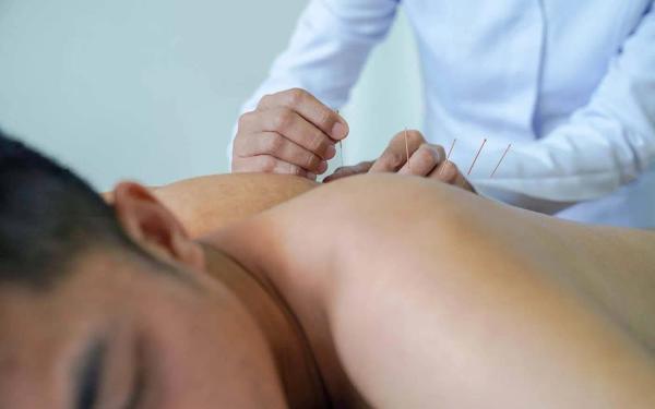 Benefits of Dry Needling in Pain Management