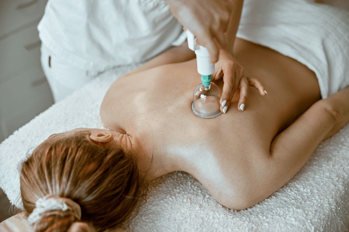 Body Cupping Technique