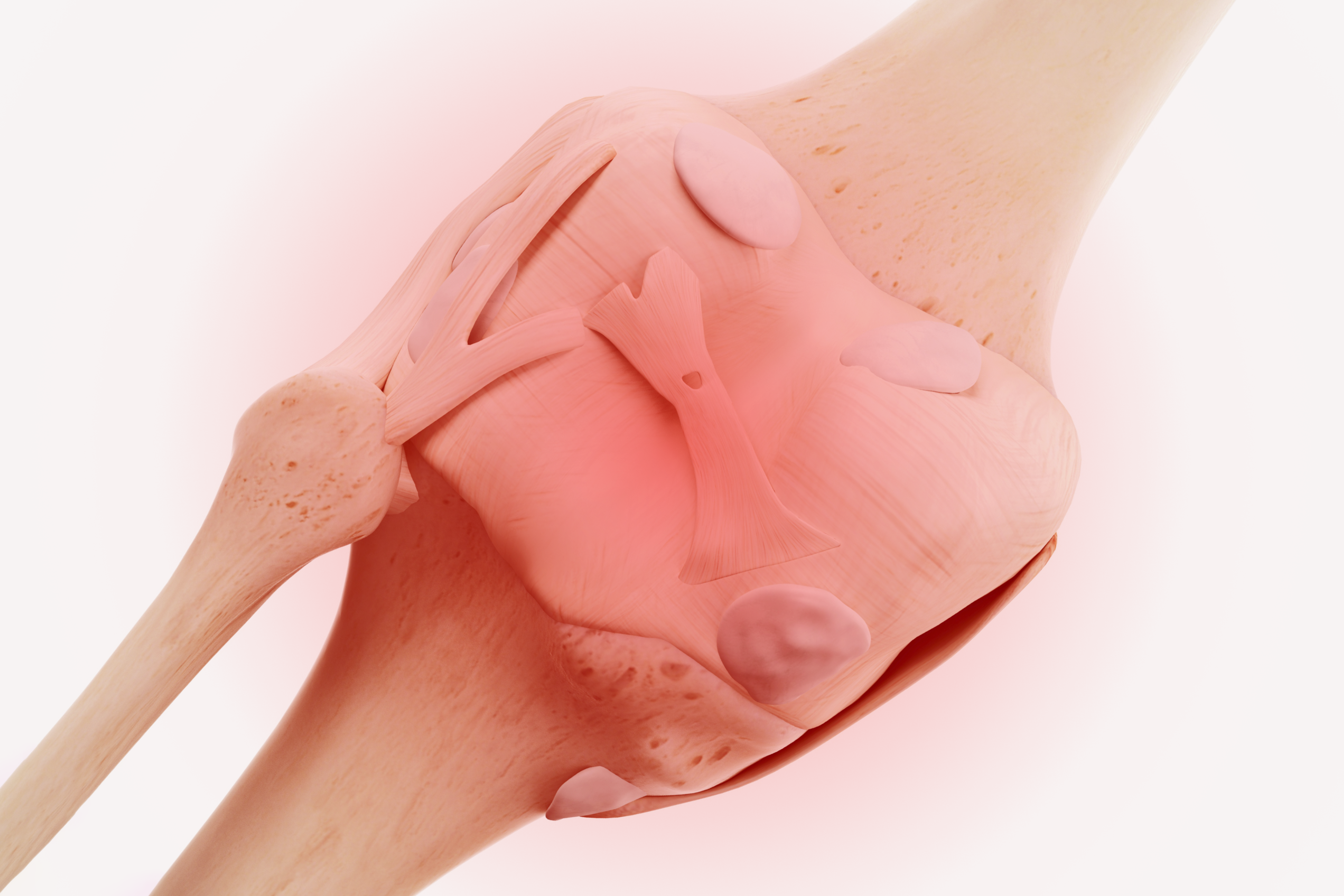 Joint inflammattion