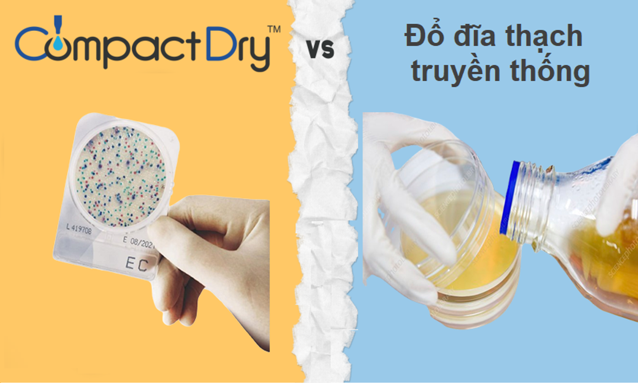 So sánh đĩa Compact Dry và phương pháp đổ thạch