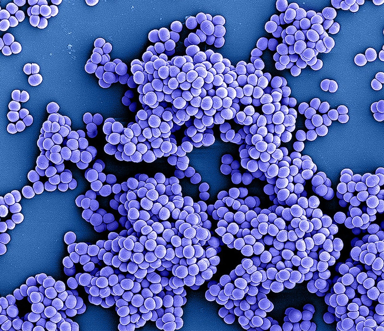 Vi khuẩn Staphylococcus aureus
