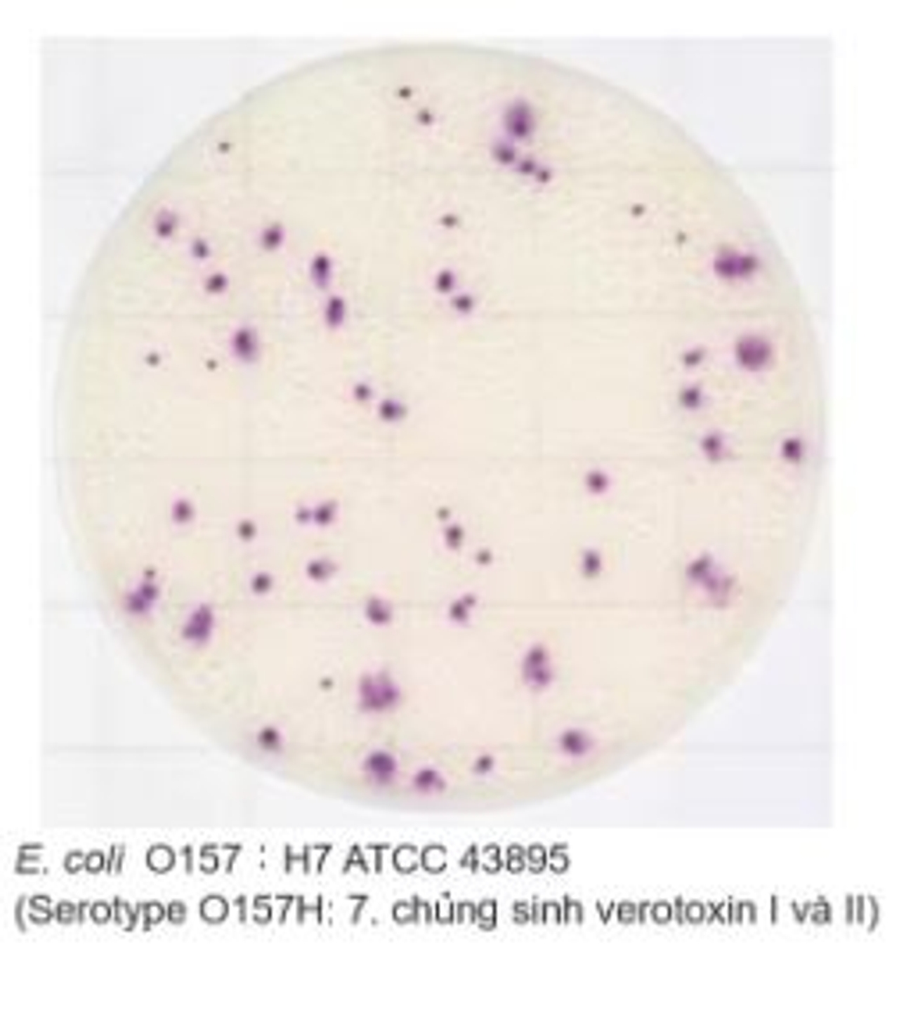 Ecoli O157 trên đĩa Easy Plate