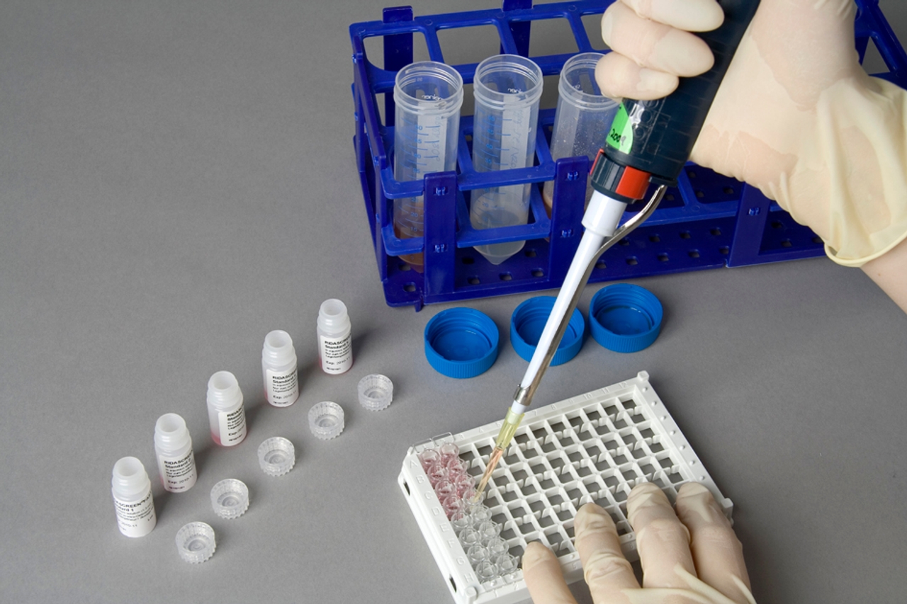 Test chất gây dị ứng theo kỹ thuật ELISA