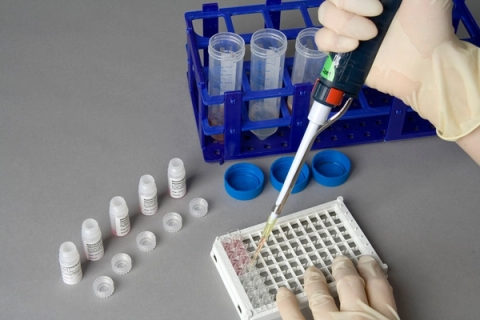 Test chất gây dị ứng theo kỹ thuật ELISA