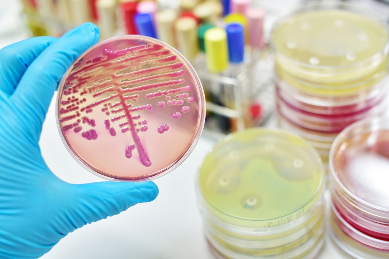 Môi trường nuôi cấy Staphylococcus aureus