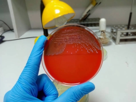 Môi trường nuôi cấy Enterobacter