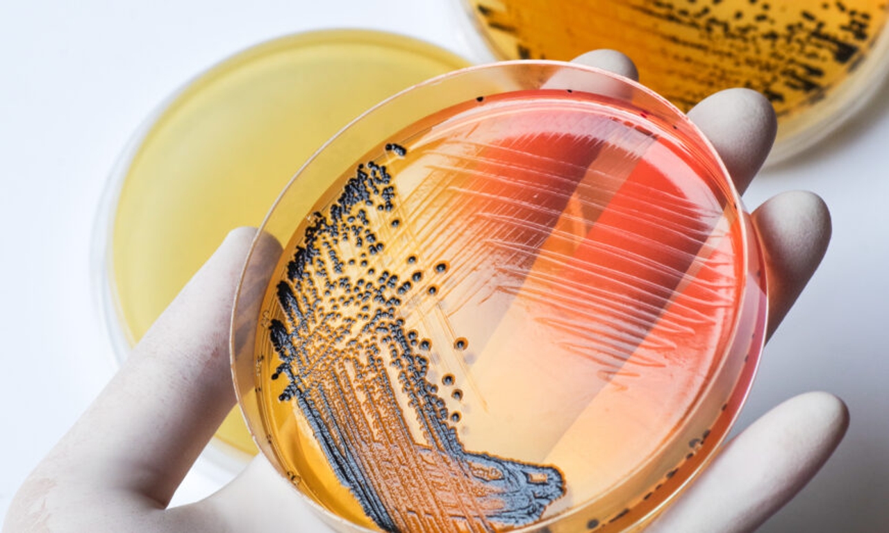 Môi trường nuôi cấy Salmonella