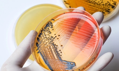 Môi trường nuôi cấy Salmonella