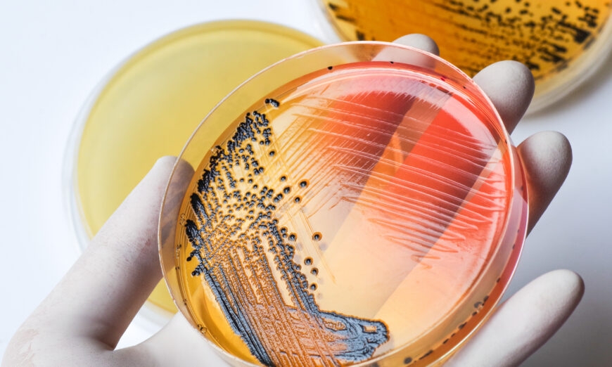Môi trường nuôi cấy Salmonella