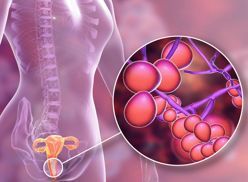 nấm men candida là một trong những loại nấm hay hại
