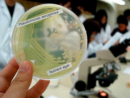 Môi trường nuôi cấy Pseudomonas aeruginosa
