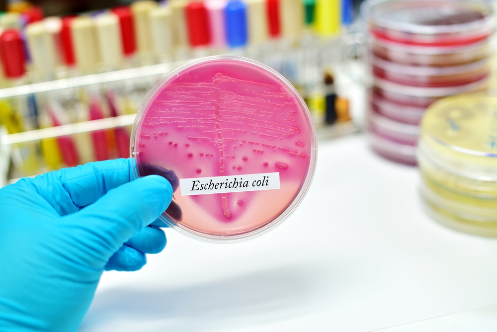 Môi trường nuôi cấy Ecoli Coliform