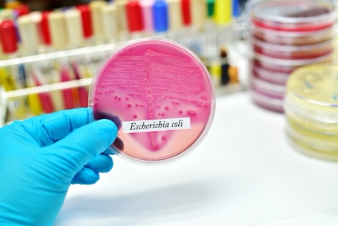 Môi trường nuôi cấy Ecoli Coliform