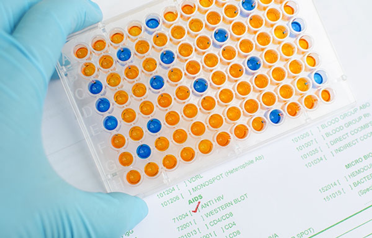 ELISA assay kit