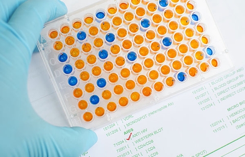 ELISA assay kit