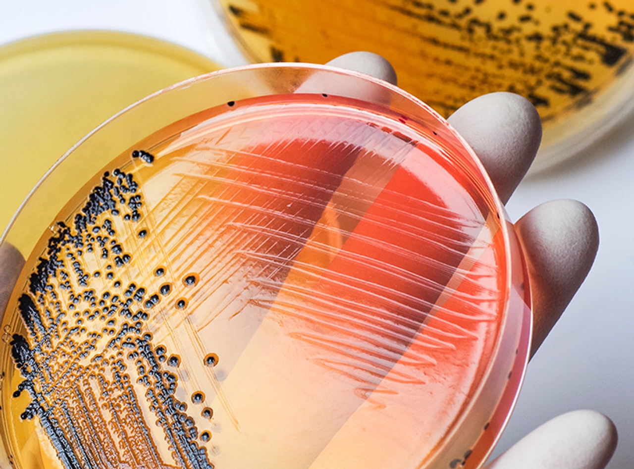 Môi trường tăng sinh Salmonella