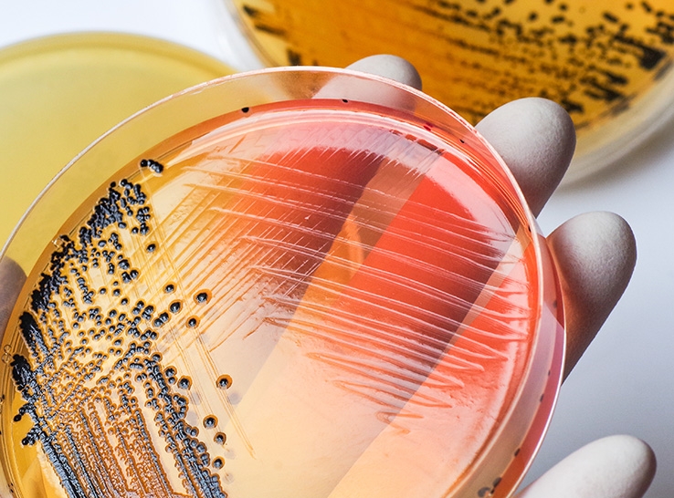 Môi trường tăng sinh Salmonella