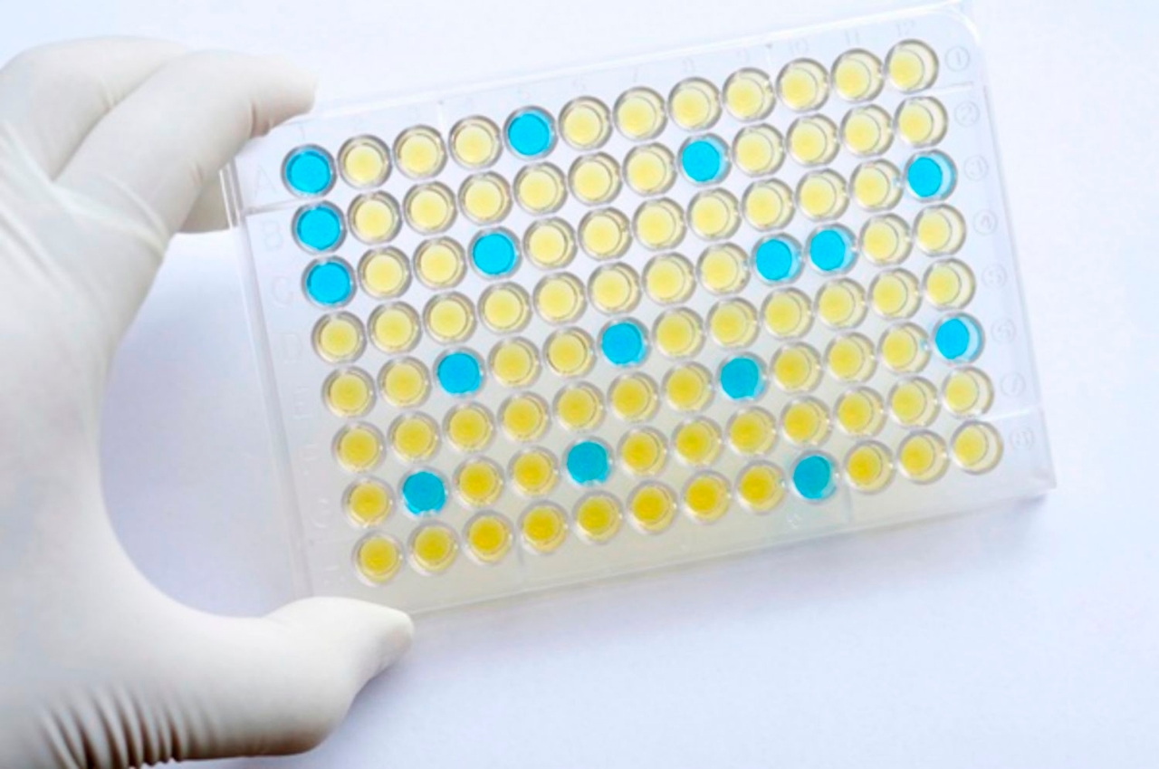 elisa test kit