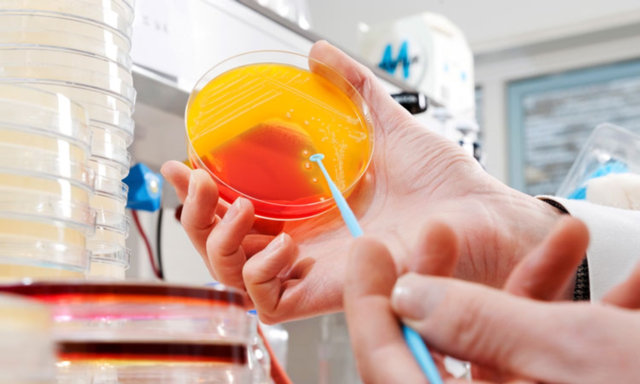 Môi trường nuôi cấy Listeria