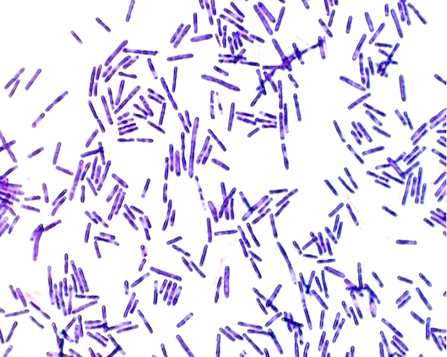 Vi khuẩn Clostridium