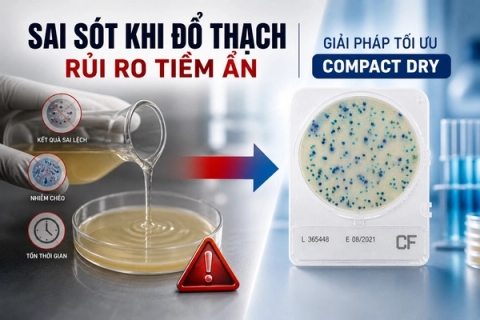 Sai sót khi đổ thạch   Rủi ro tiềm ẩn mà nhiều phòng lab bỏ qua