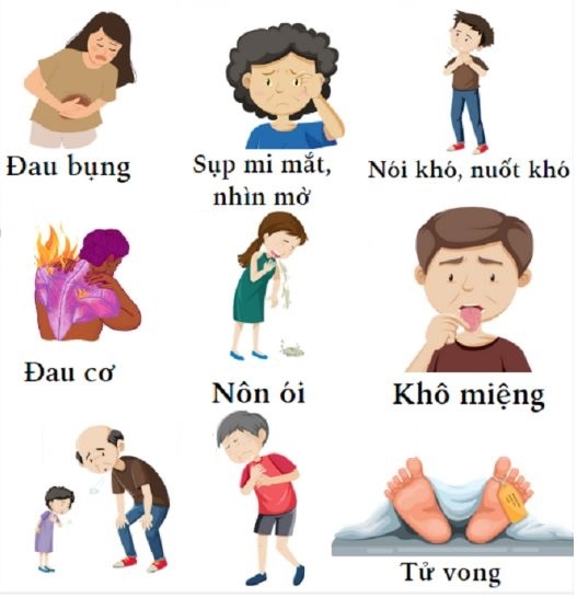 Triệu chứng ngộ độc Botulinum