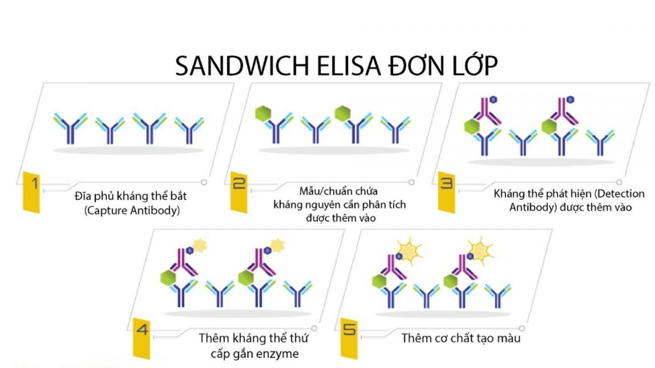 Kỹ thuật Ellisa sanwich