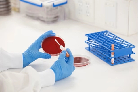 Môi trường nuôi cấy Bacillus