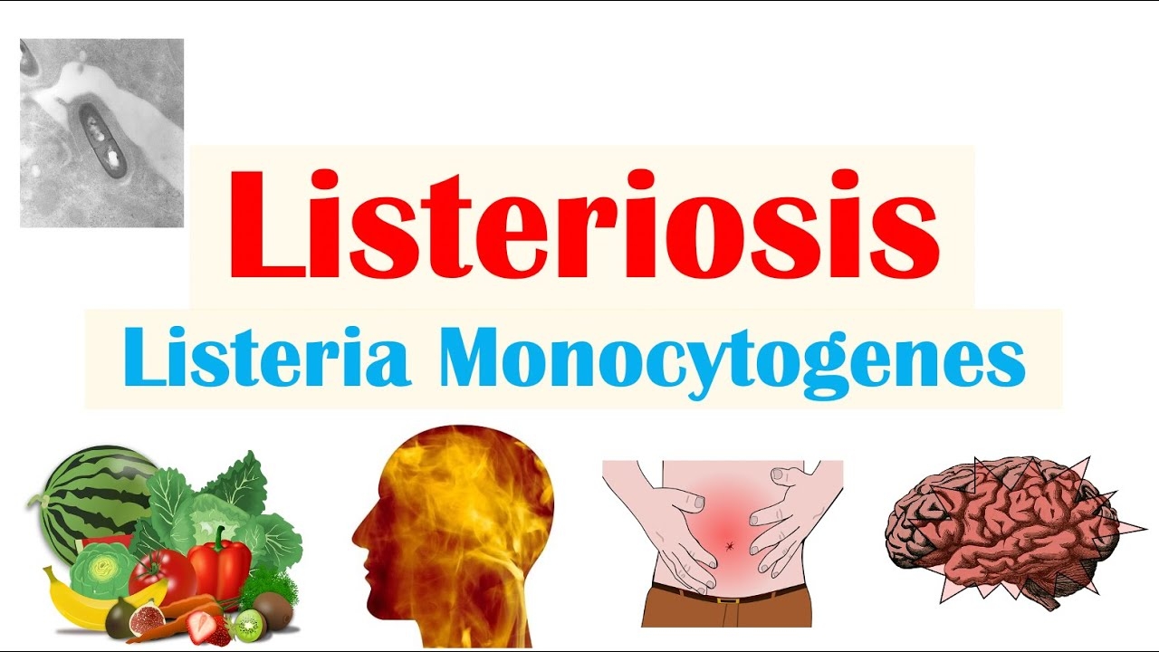 Vi khuẩn Listeria monocytogenes