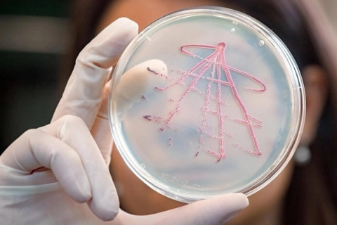 Môi trường nuôi cấy Clostridium perfringens