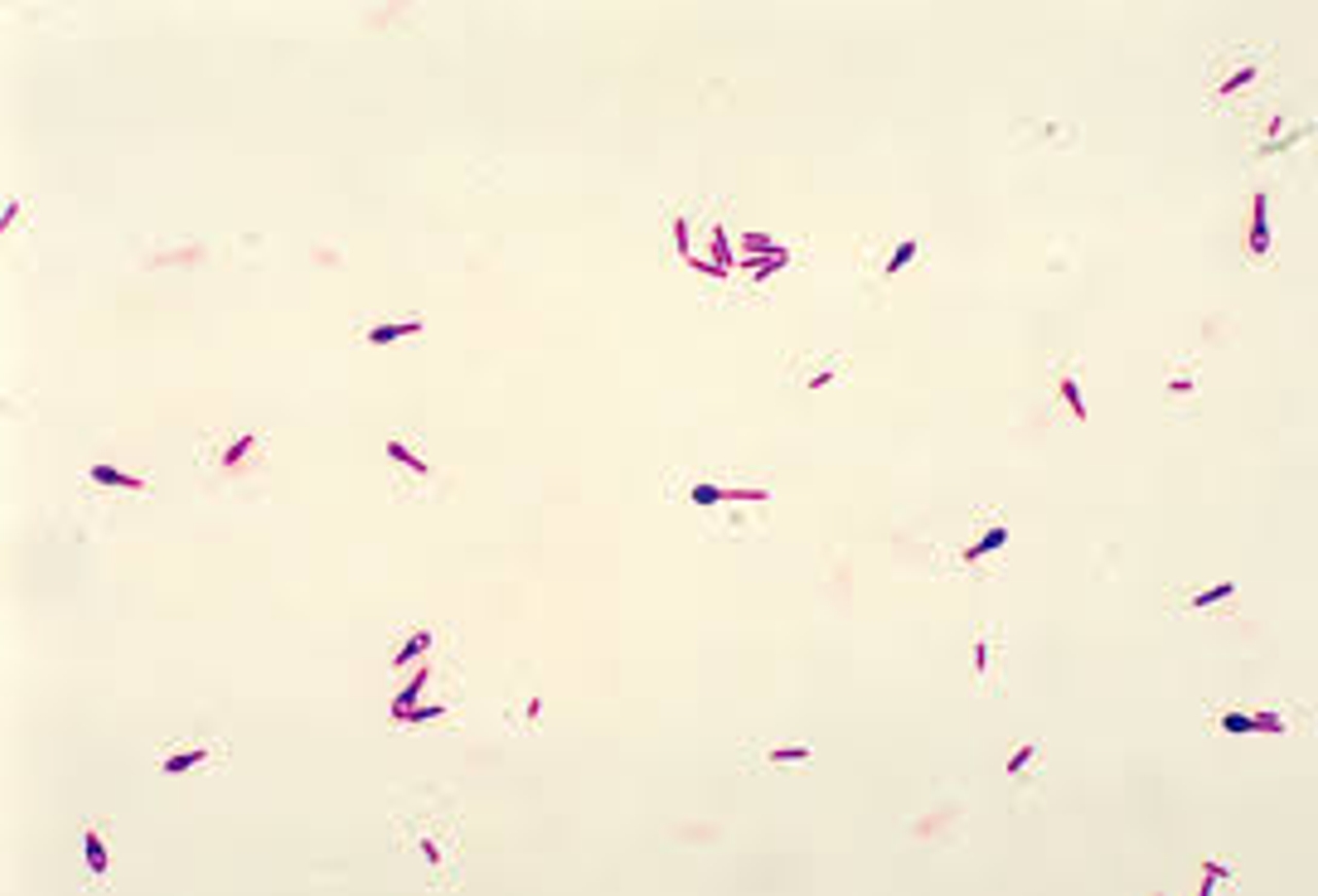 Clostridium botulinum trong thực phẩm