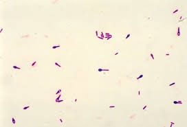 Clostridium botulinum trong thực phẩm