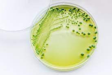 Môi trường nuôi cấy Vibrio parahaemolyticus