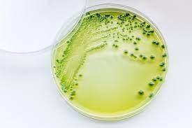 Môi trường nuôi cấy Vibrio parahaemolyticus