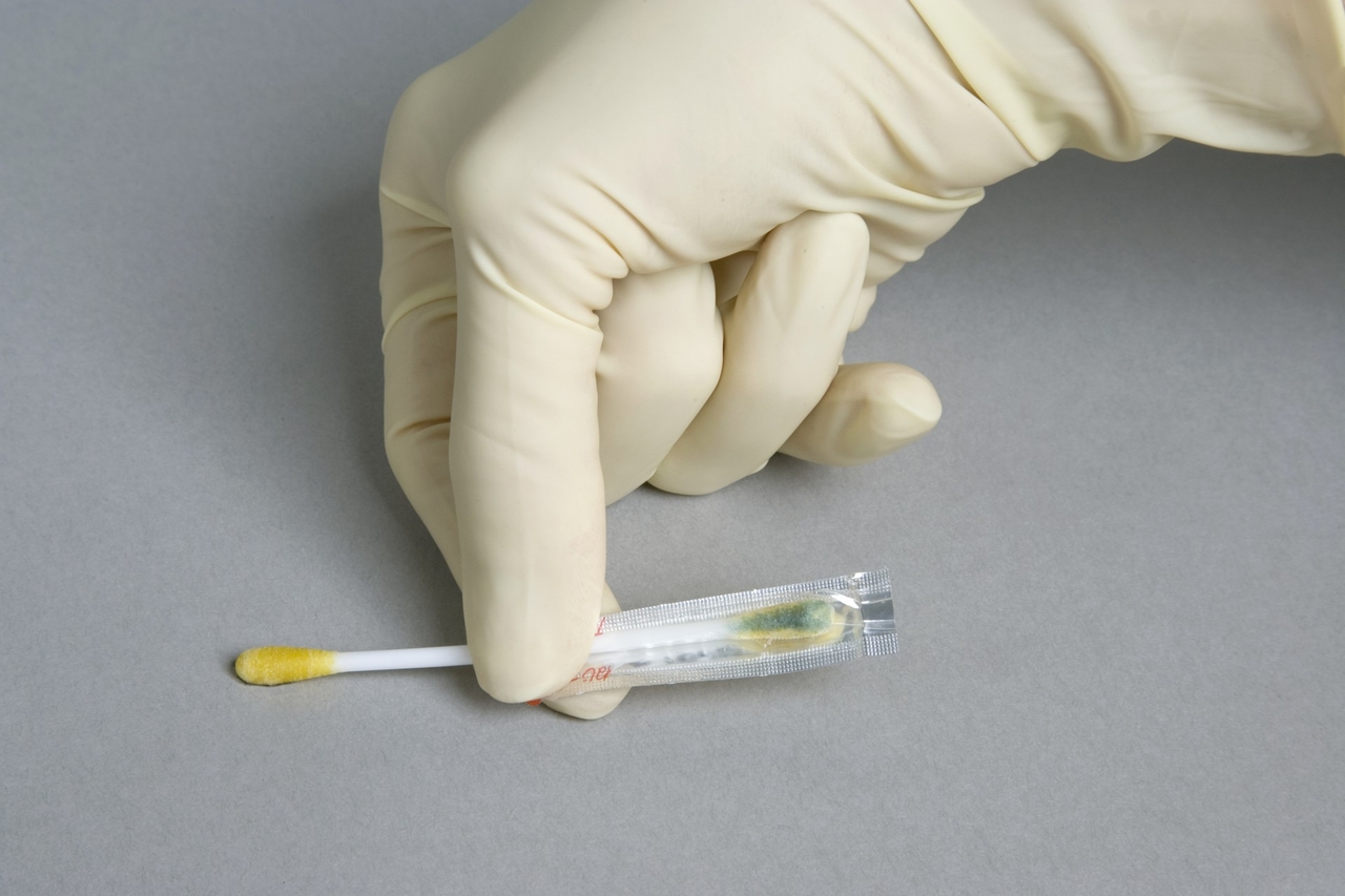 Que test protein bề mặt
